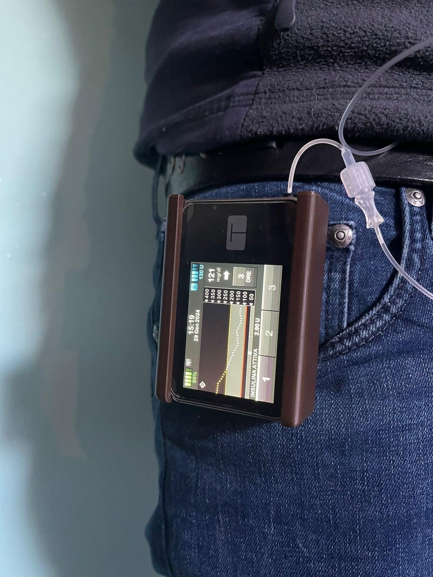 cover rigida per microinfusore Tandem T:slim x2