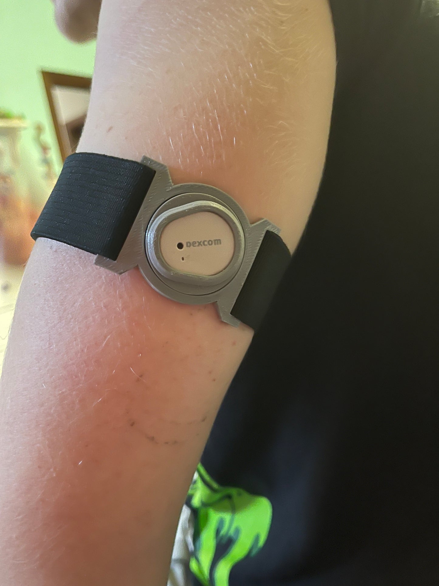 Dexcom G7 Sensor Strap