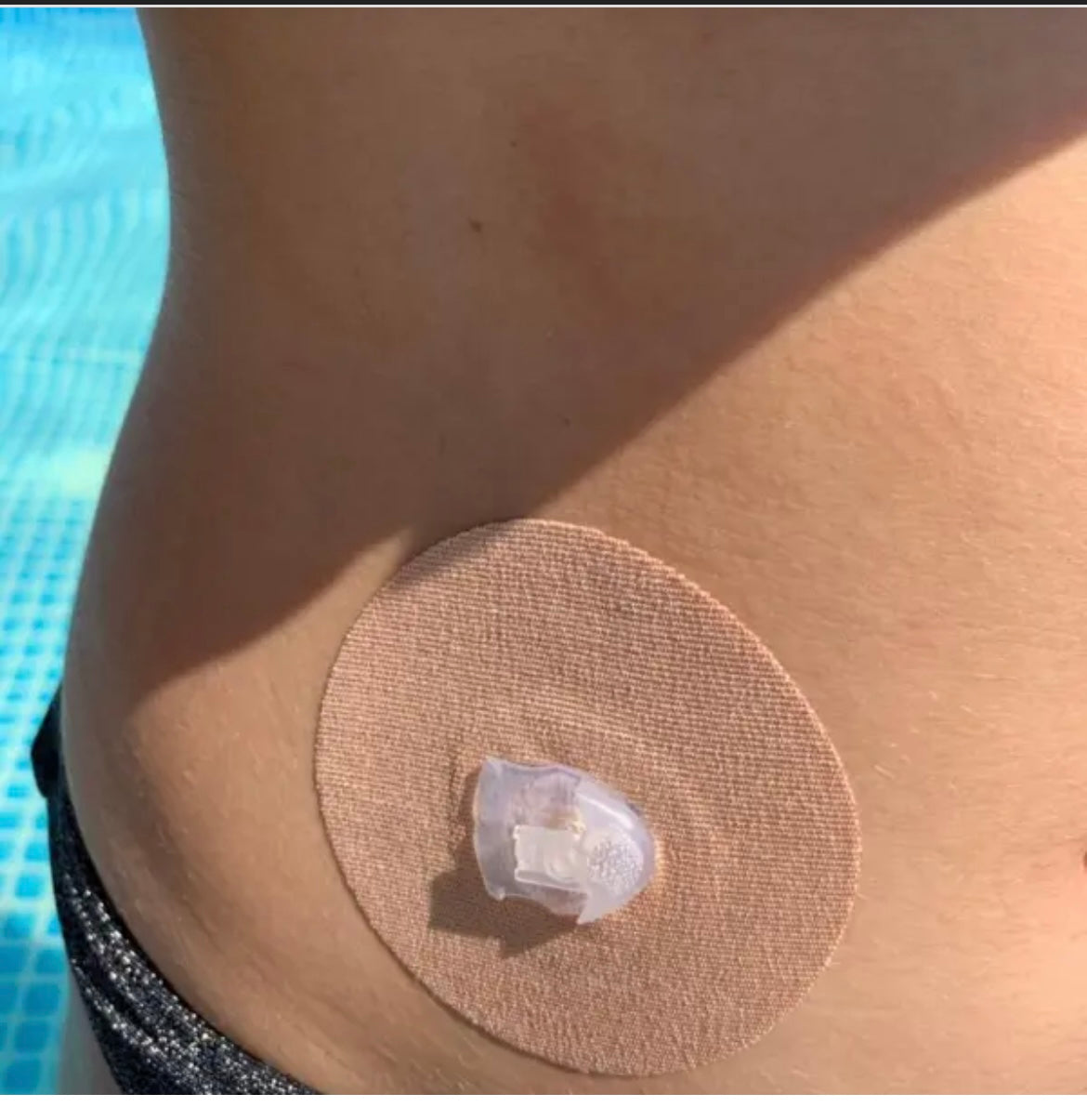 Patch for Dexcom G6